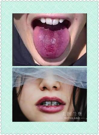 為什么喝了紅酒舌頭發紫(喝了紅酒舌頭發紫是什么原因)